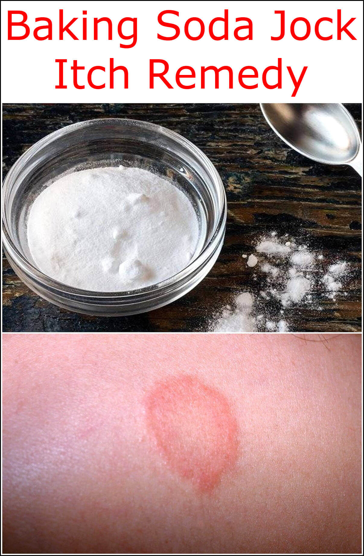 baking soda for female jock itch rash