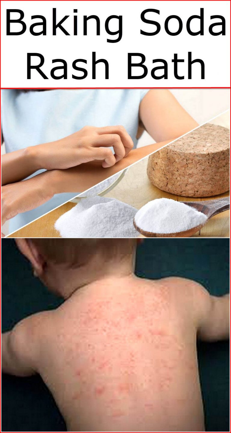 baking-soda-rash-bath-baking-soda-uses-and-diy-home-remedies