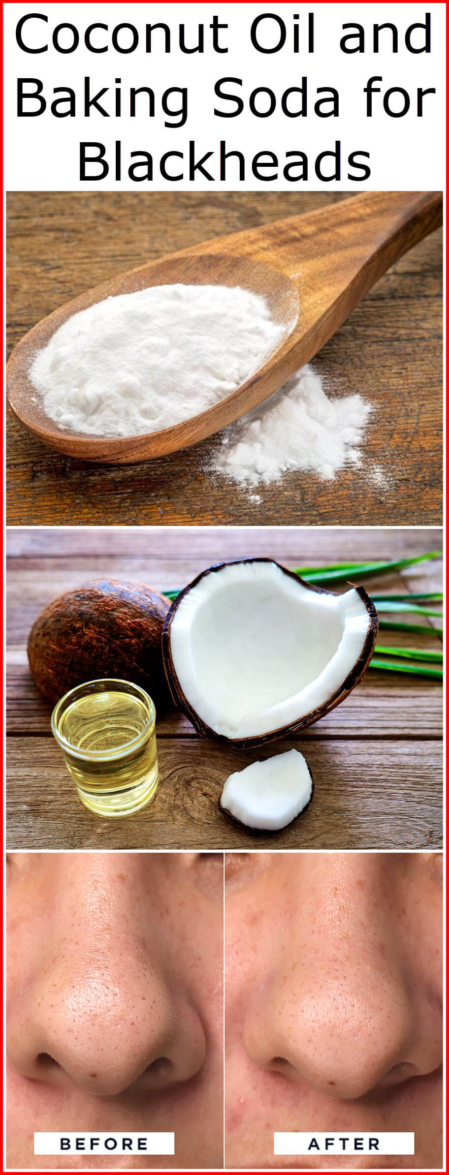 How To Use Baking Soda And Coconut Oil On Face